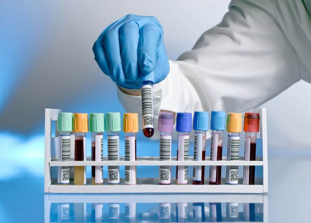 בדיקת דם לאיתור הפרשות פתולוגיות בזמן עוררות